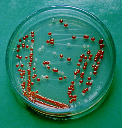 Izolacija čiste kulture – kolonije na hranjivom agaru