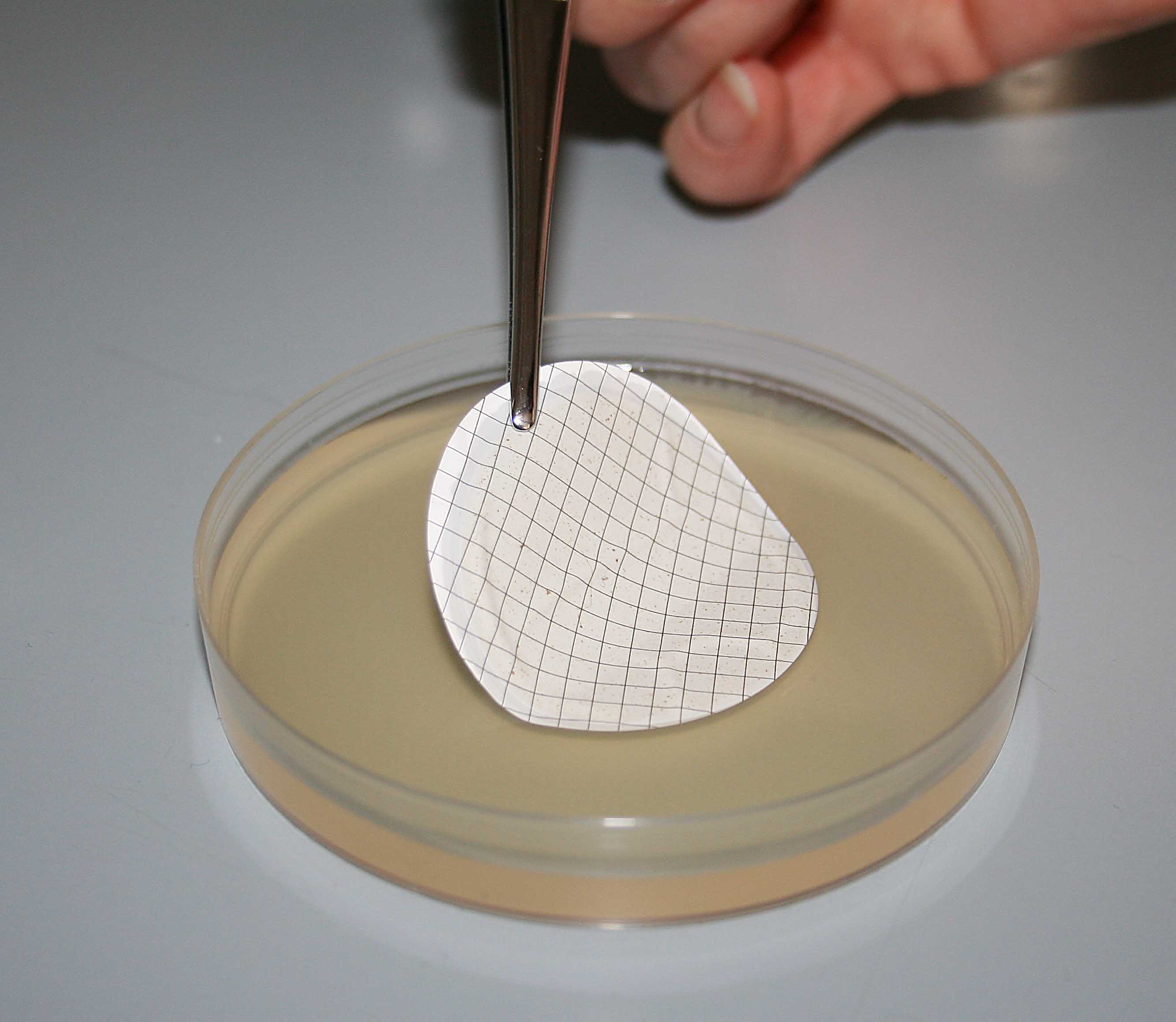 Postavljanje membranskog filtra na hranjivu podlogu.