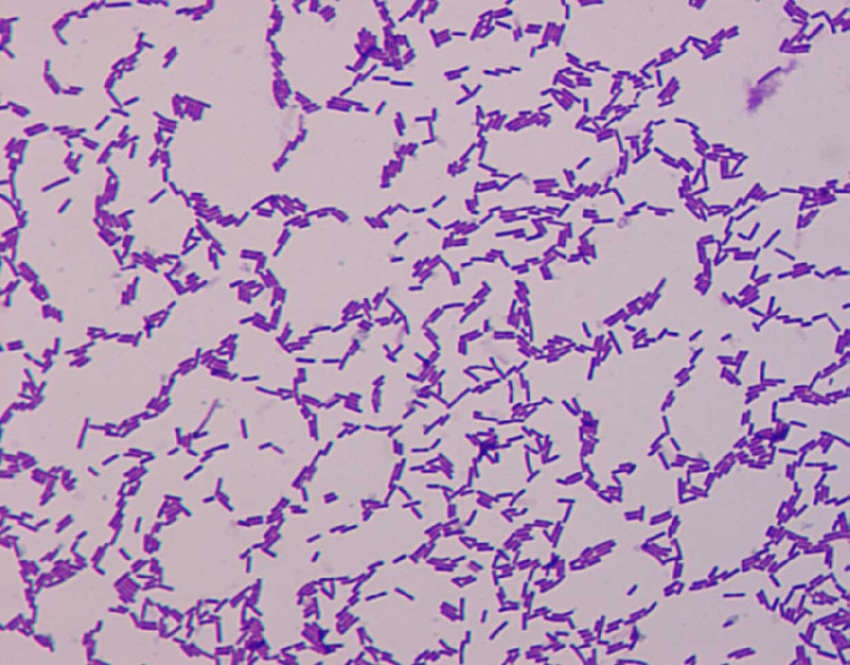 Slika 21a – Gram-pozitivne bakterije