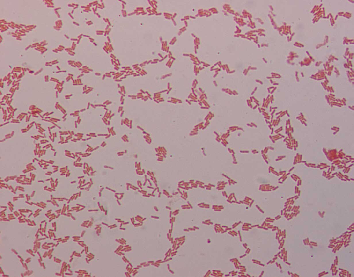 Slika 21b – Gram-negativne bakterije