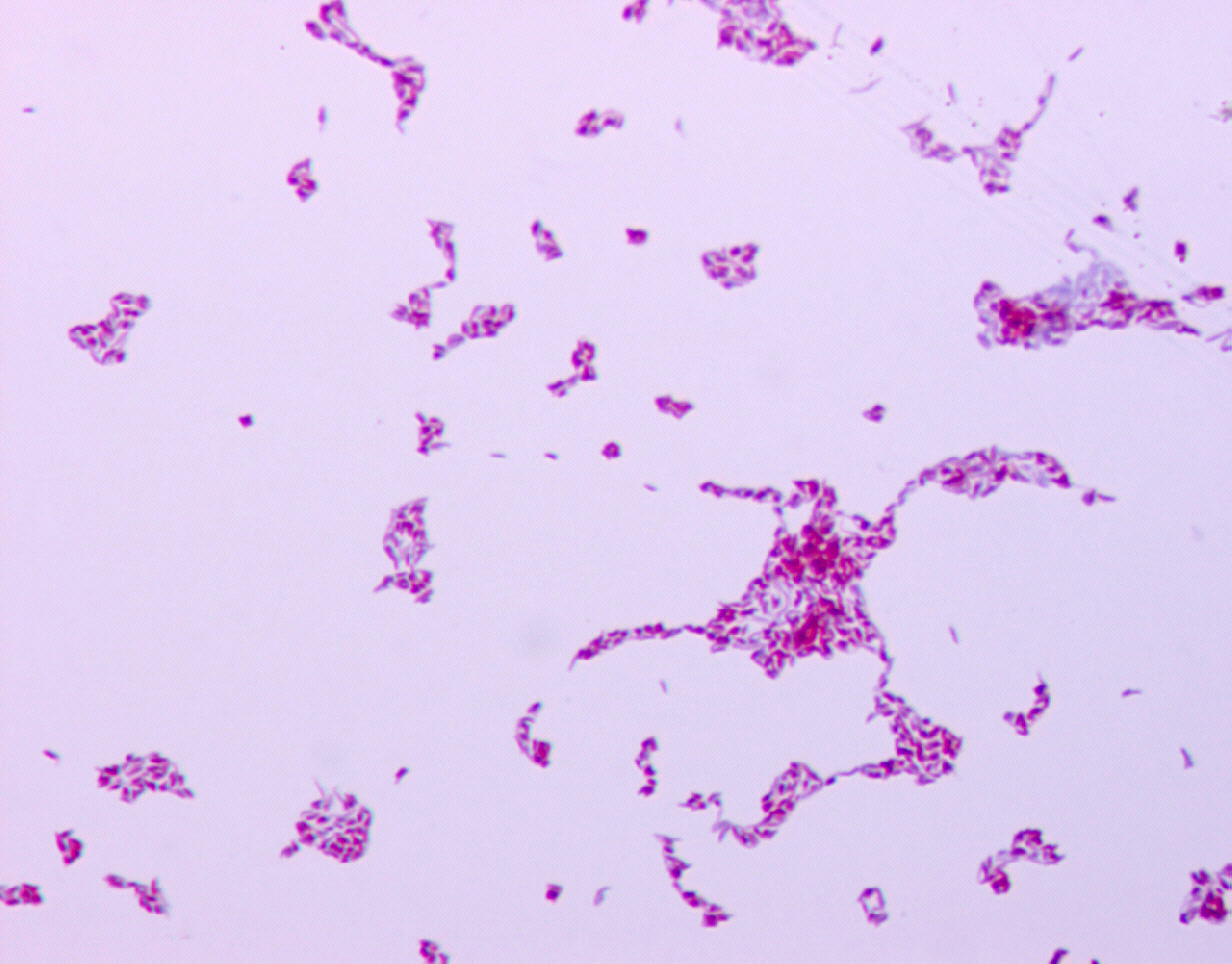 Slika 24 – Stanice Mycobacterium phei
