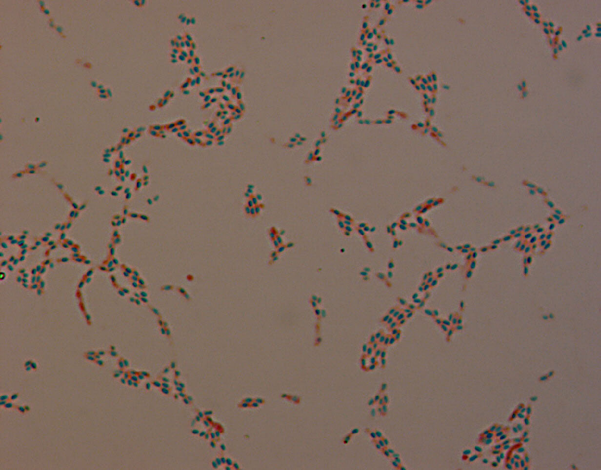 Slika 25 – Bakterijske endospore