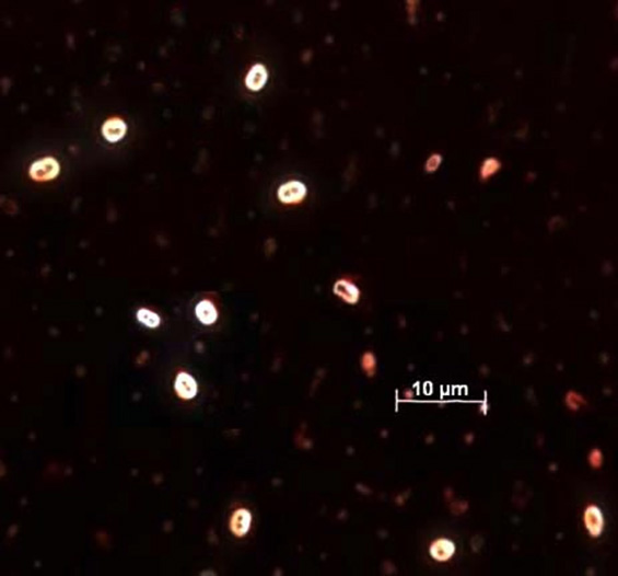 Slika 26 – Bezbojne kapsule