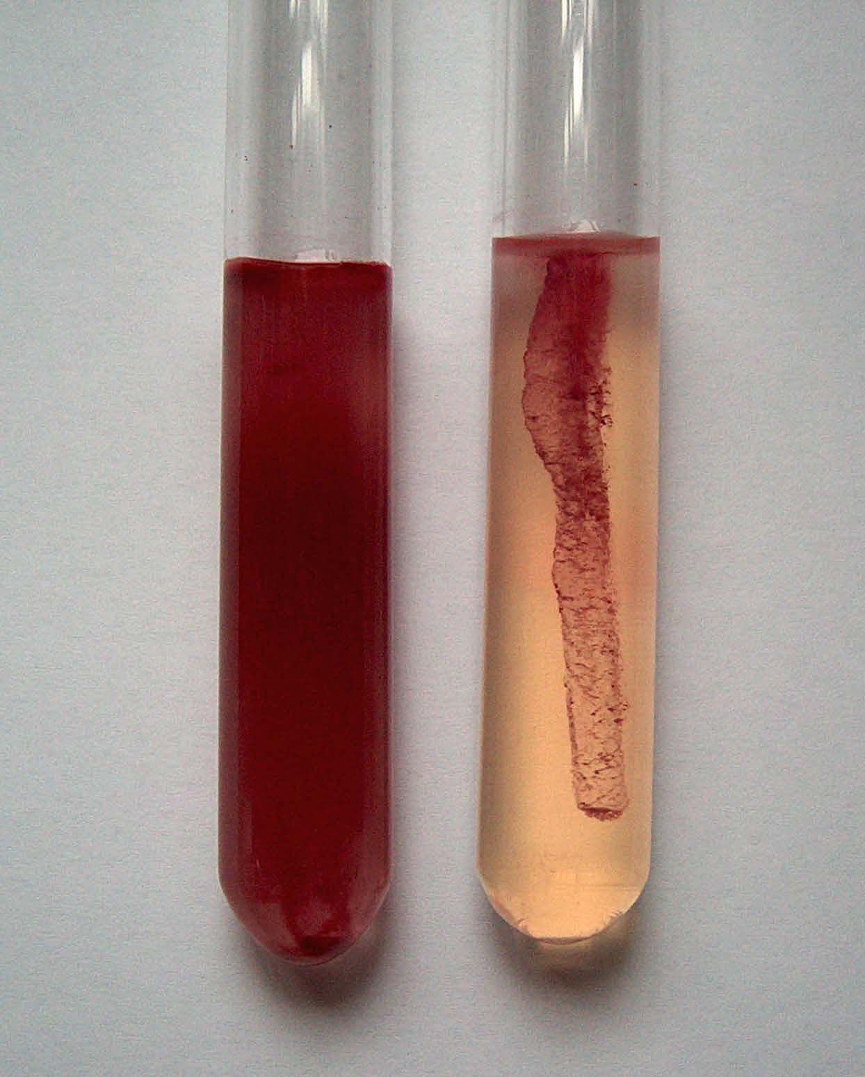 Slika 27 – Pokretna i nepokretna bakterija