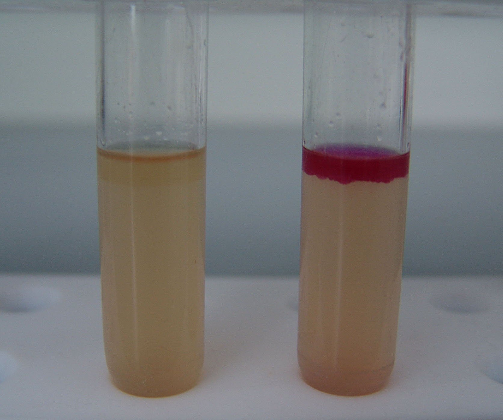 Pozitivna (desno) i negativna (lijevo) reakcija na indol