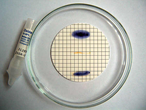 Plavo obojenje kod pozitivnog oksidaza testa (u sredini je test negativan)