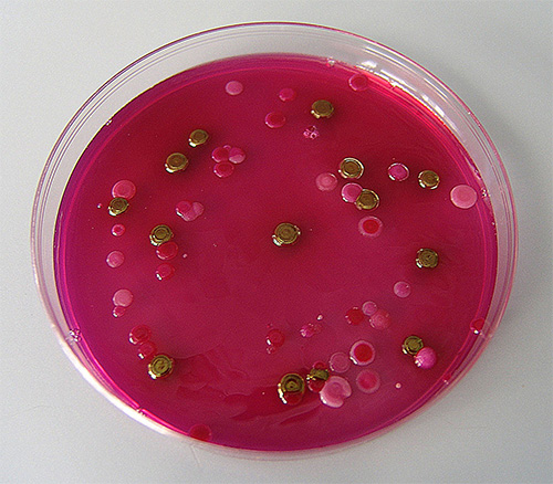 Kolonije Escherichia coli zlatnog metalnog sjaja i roza kolonije ostalih koliformnih bakterija porasle na Endo agaru
