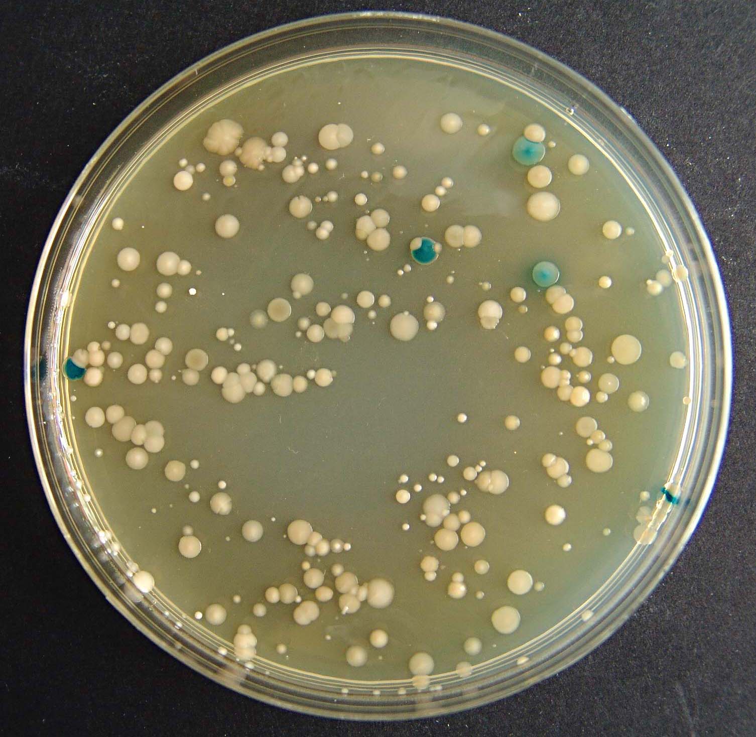 Plavo obojene kolonije Escherichia coli i žućkasto obojene kolonije drugih koliformnih bakterija na EC X-GLUC agaru