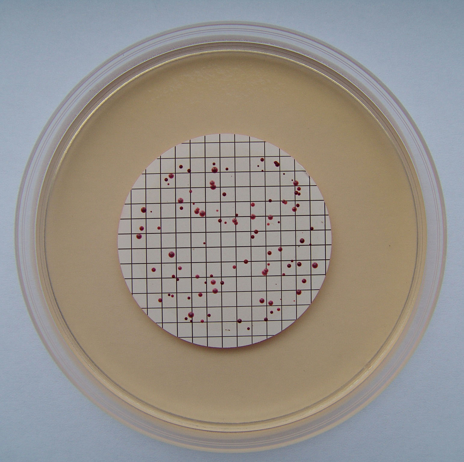 Crvene kolonije crijevnih enterokoka porasle na Slanetz-Bartleyevu agaru