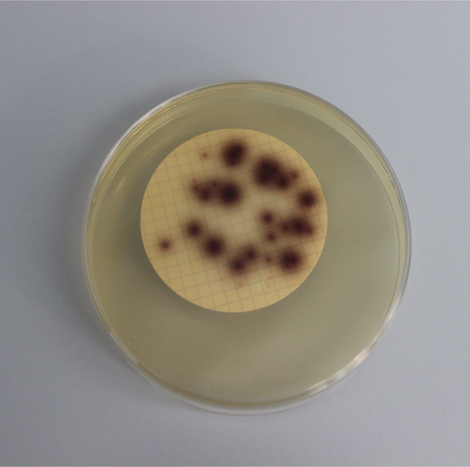 Crno-smeđa zona oko kolonija crijevnih enterokoka na Bile aesculin azide agaru