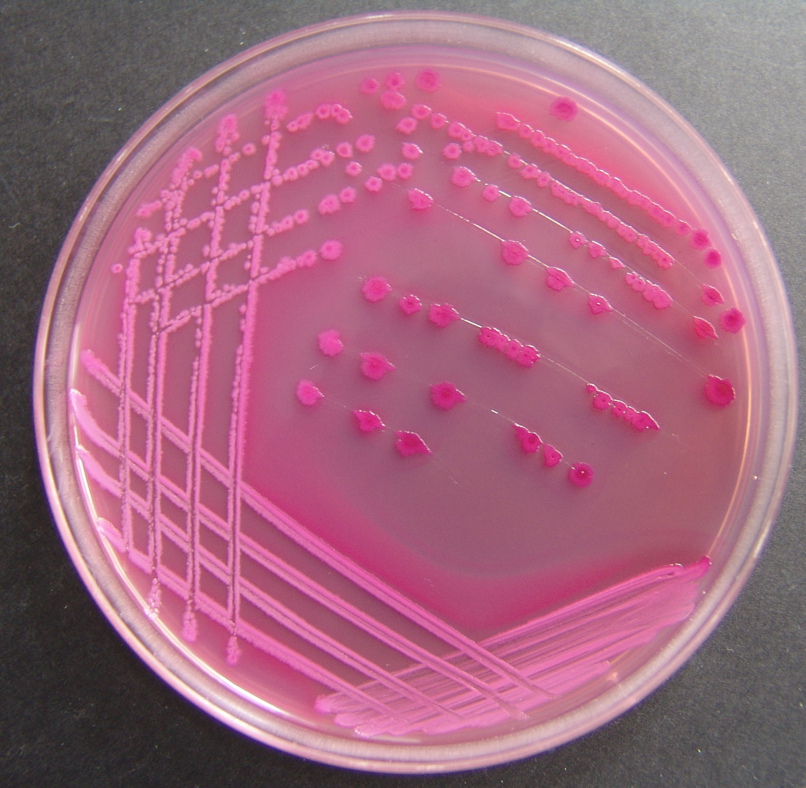 Tipične crvene kolonije Escherichia coli i roza kolonije ostalih koliformnih bakterija porasle na MacConkeyevu agaru