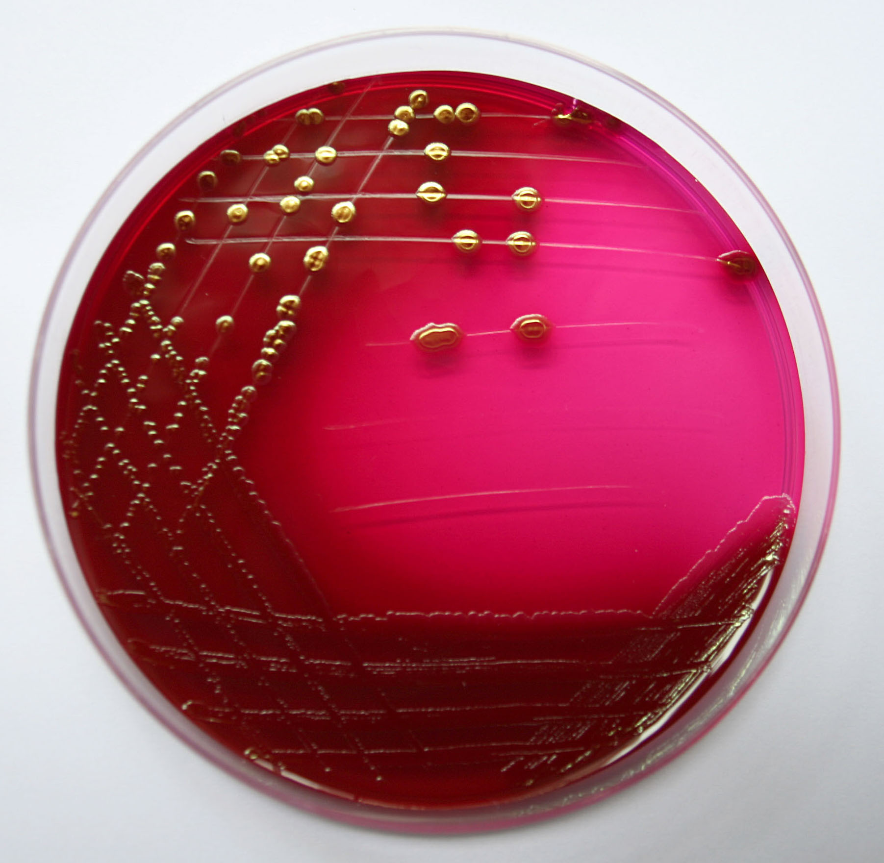 Tipične kolonije E. coli na Endo agaru s metalnozlatnim sjajem