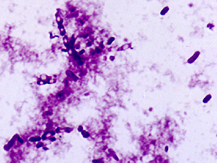 Bakterije roda Bacillus obojene po Gramu
