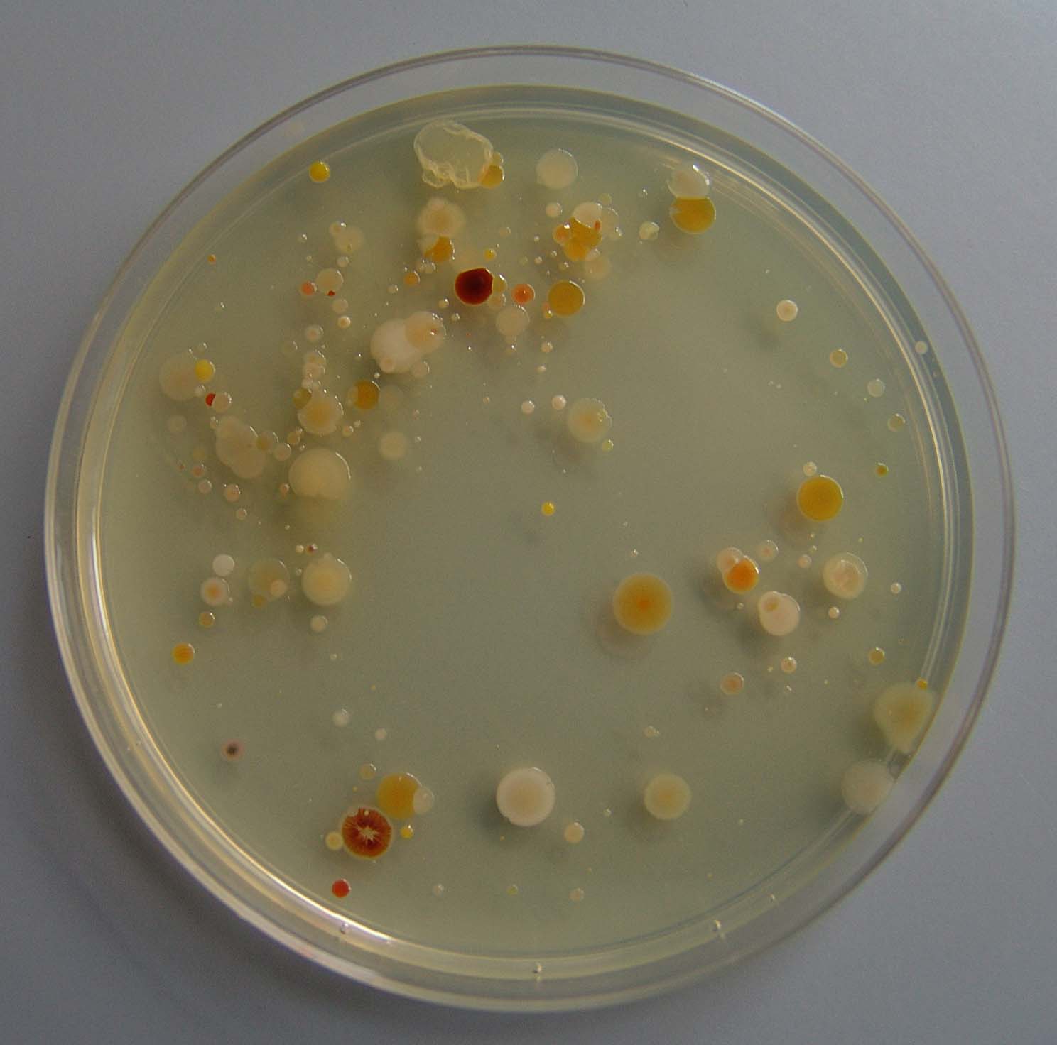 Kolonije anaerobnih bakterija porasle na hranjivom agaru