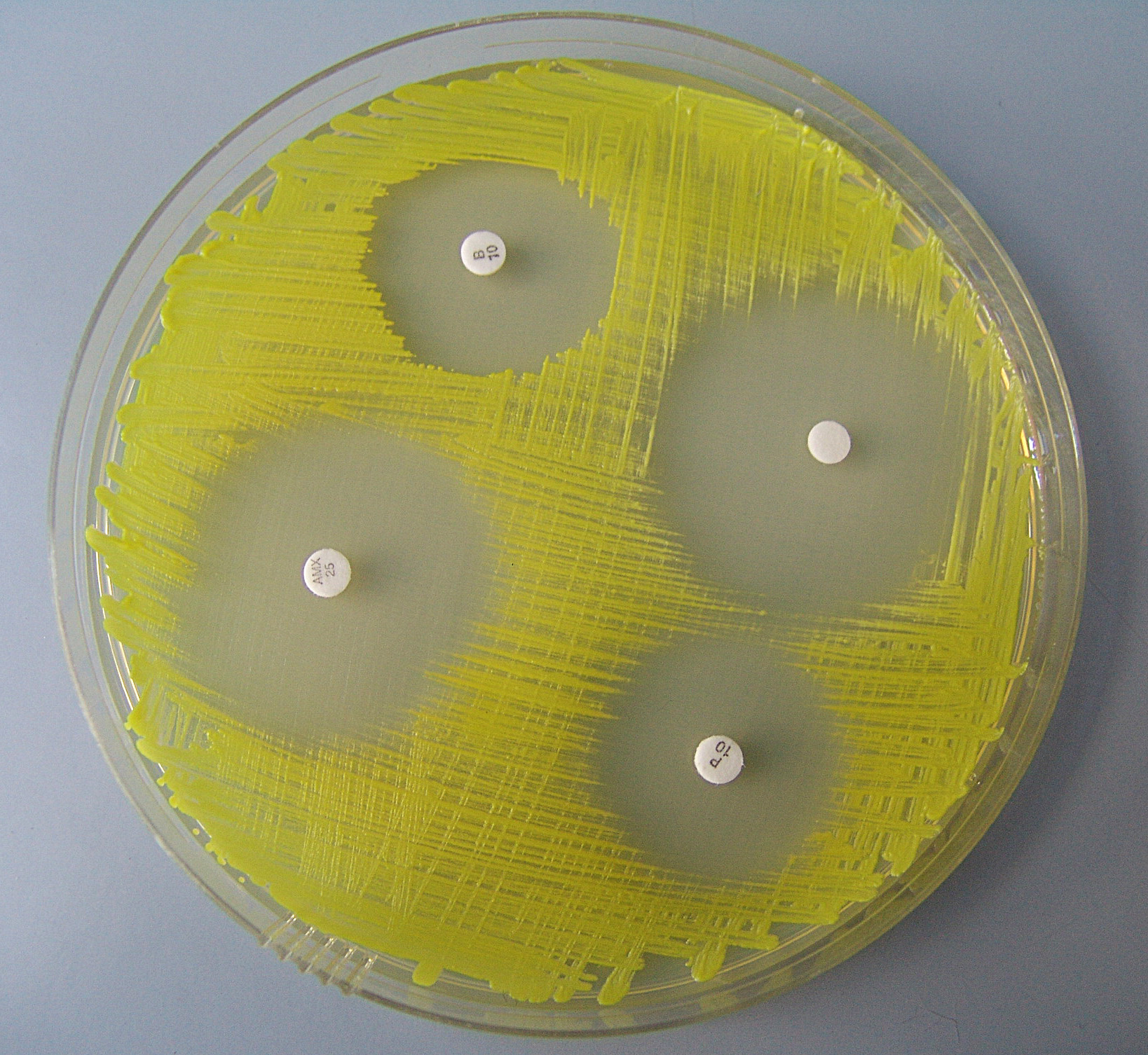 Zona inhibicije rasta bakterije Micrococcus luteus oko diskova s antibioticima