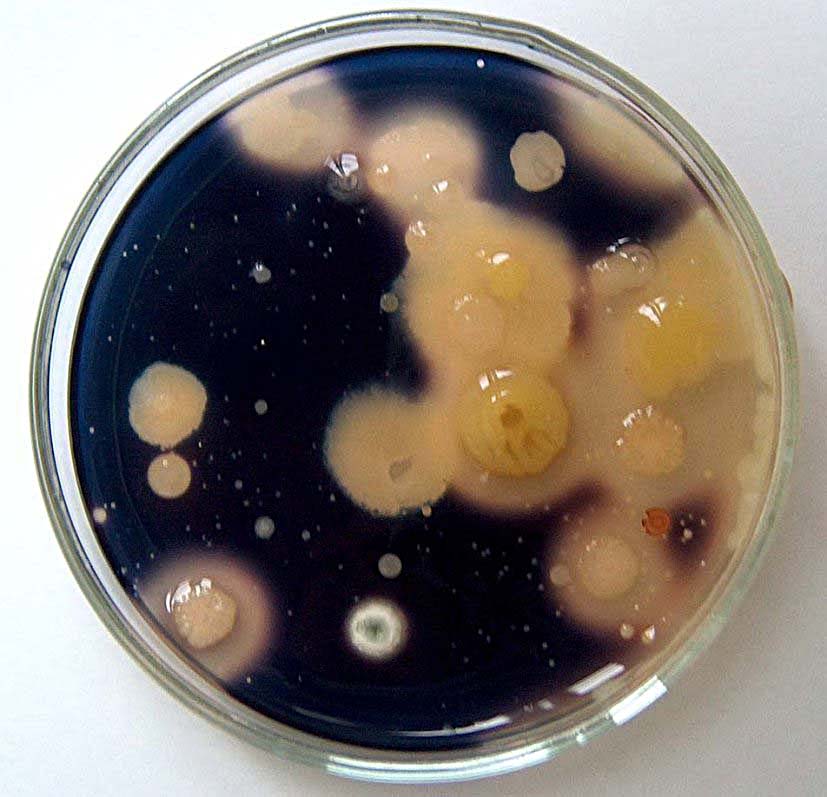 Obezbojene zone hidrolize škroba oko kolonija amilolitičkih bakterija nakon reakcije s lugolom