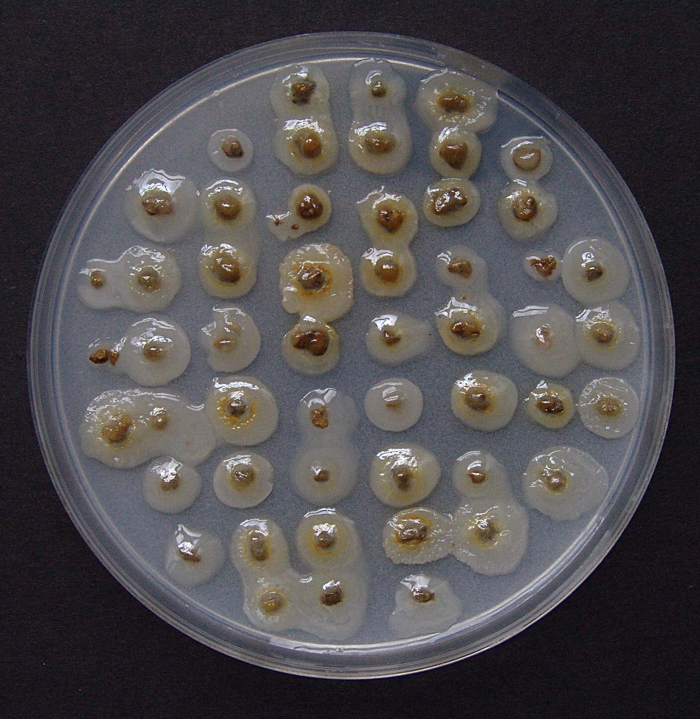 Zrnca tla okružena kolonijama fiksatora dušika uzgojenim na Ashby agaru