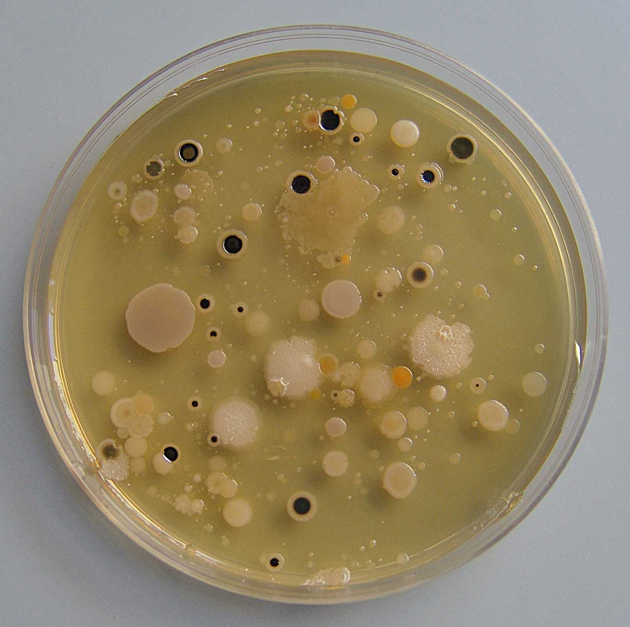 Crno obojene kolonije bakterija proizvođača sumporovodika iz proteina izolirane na pepton-amonij citrat agaru