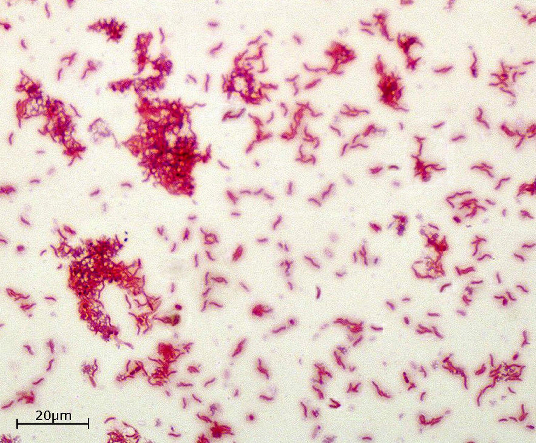 Fiziološka skupina sulfat reducirajućih bakterija obojena po Gramu, uzgojena u podlozi Postgate's E