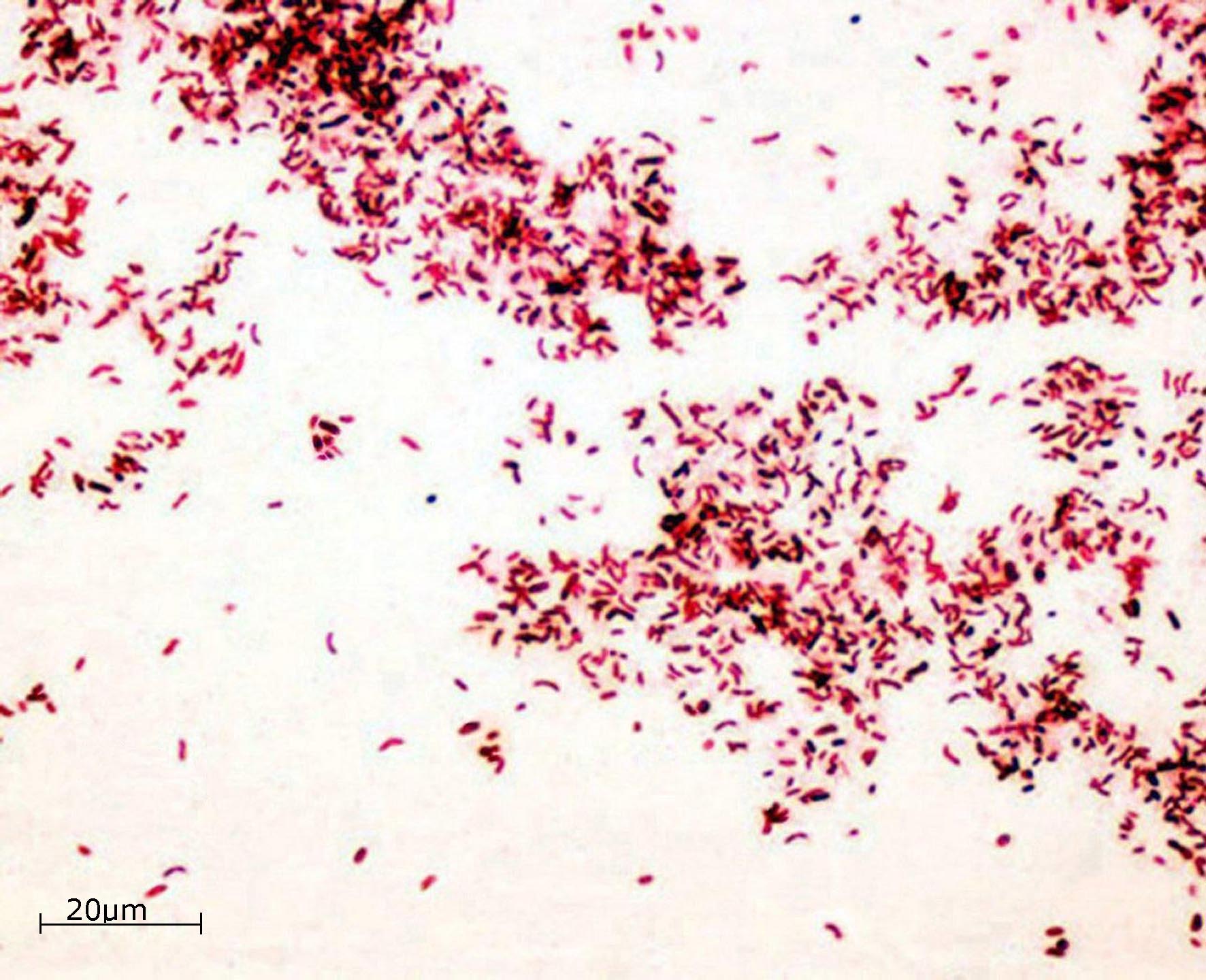 Fiziološka skupina sulfat i tiosulfat reducirajućih bakterija obojena po Gramu, uzgojena u STM podlozi