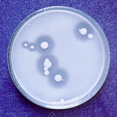 Kolonije bakterija fosfomobilizatora izolirane na podlozi za fosfomobilizatore