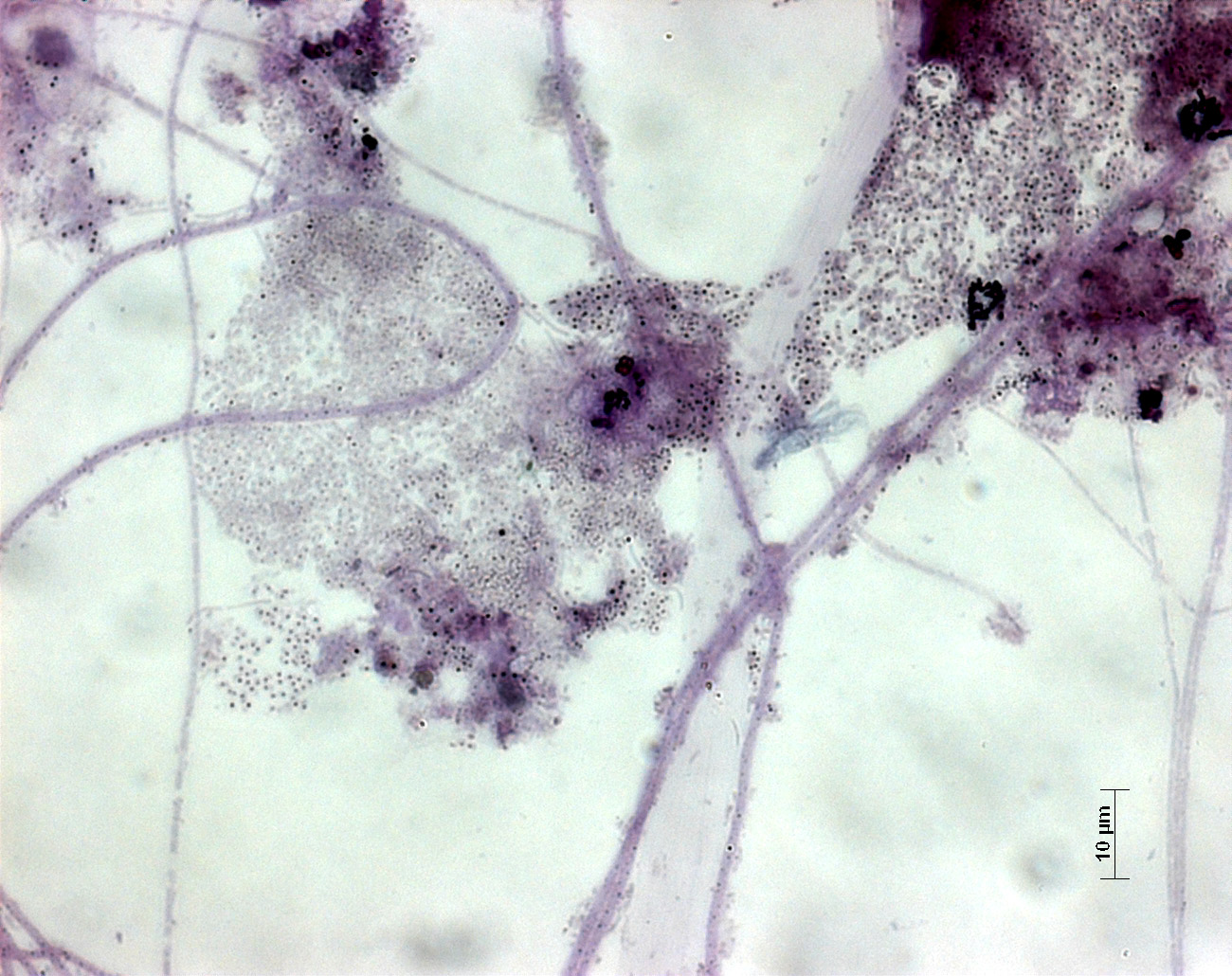 Plavo obojena zrnca polifosfata u flokuli aktivnog mulja
