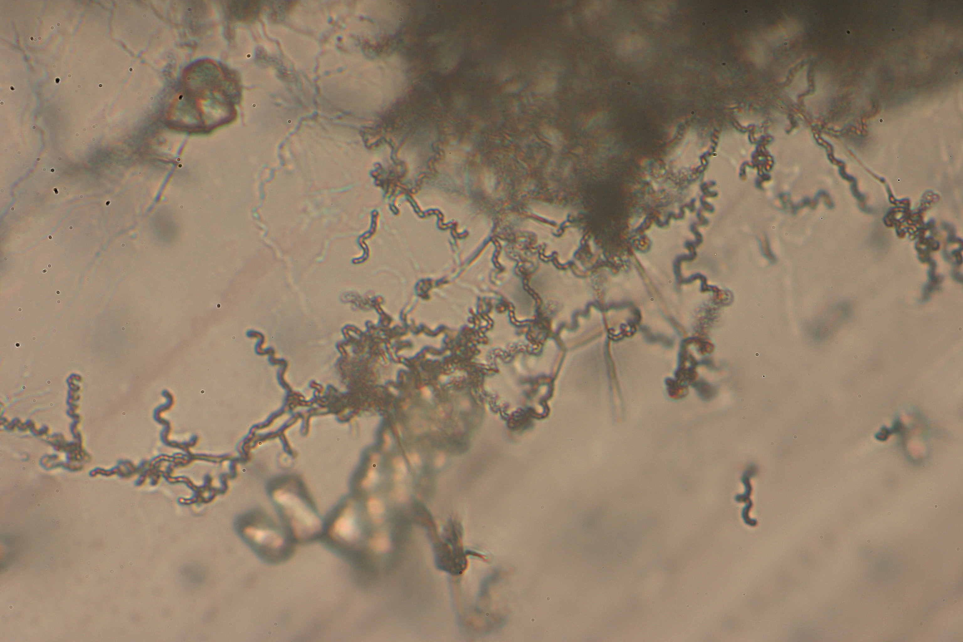 Zračne hife streptomiceta tipa spira