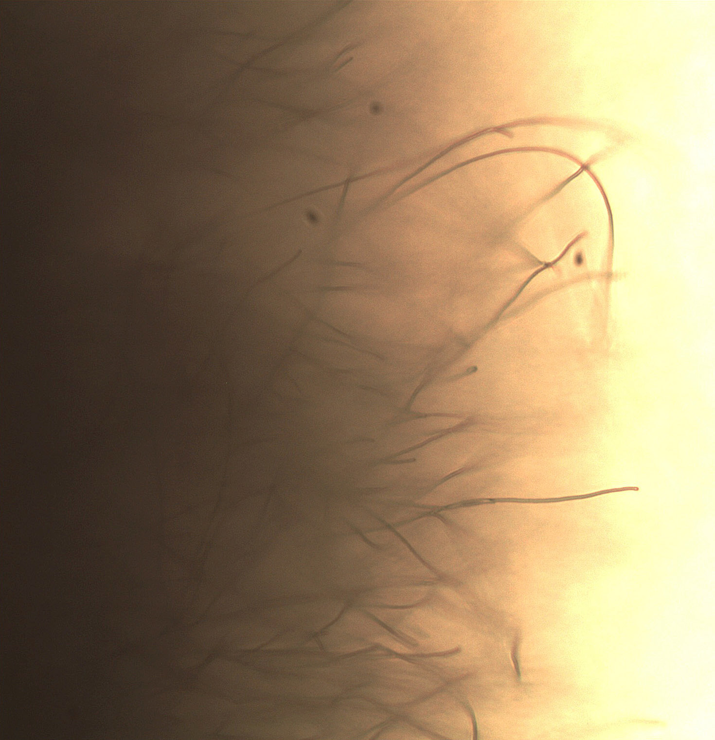 Ravni sporofori streptomiceta