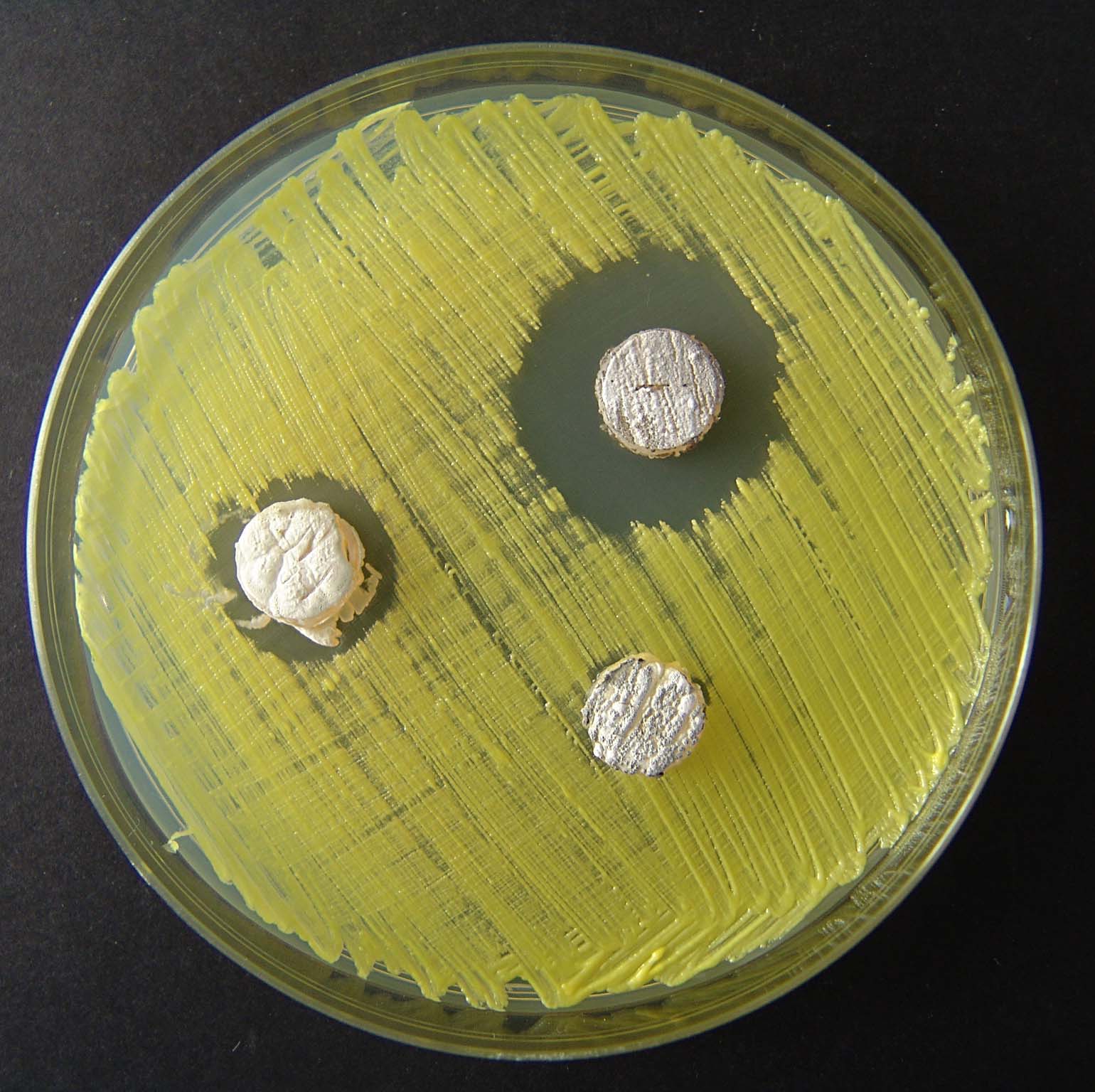 Zone inhibicije rasta bakterije Micrococcus luteus oko diskova agara sa streptomicetima